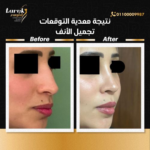 معايير اختيار أفضل عيادة تجميل الانف في مصر